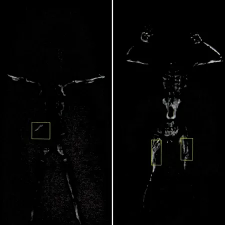 Досмотровый сканер Генезис МД-02А, мм-волновый