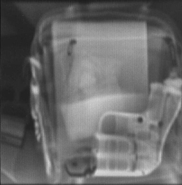 Рентгеновское устройство досмотра полостей Феникс